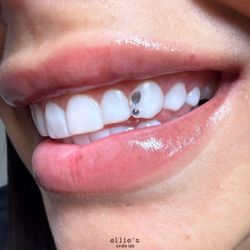Tooth Gems