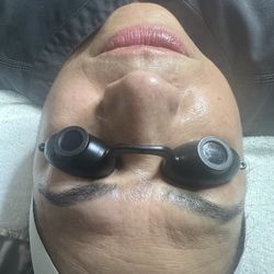 Facial