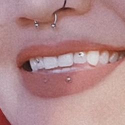 Tooth Gems , Teeth Whitening