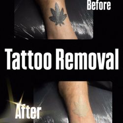 Removal