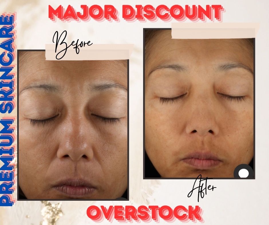 Premium Wrinkle Removing Cream – Discount!