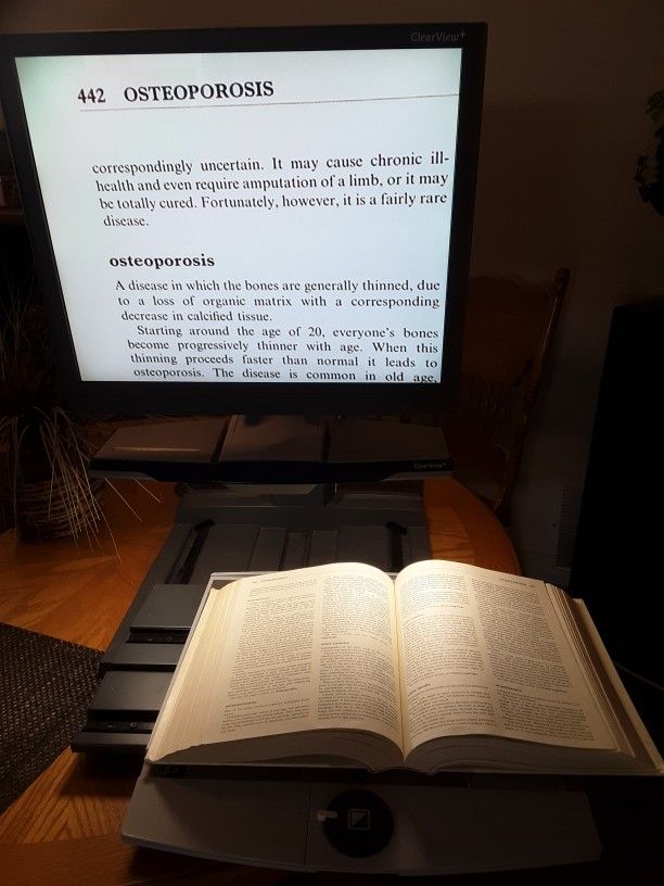 Low Vision Video Magnifier for Sale in Menifee, CA OfferUp