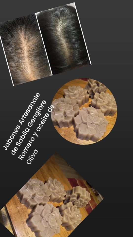 Jabon Para La Caida De Pelo