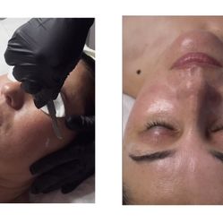 Professional Facials 