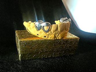 Custom Gold Grillz 