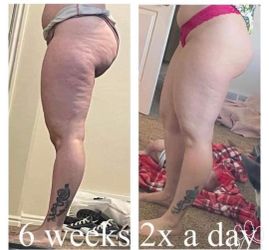 WORLD'S #1 BEAUTY DEVICE SYSTEM AT HOME 