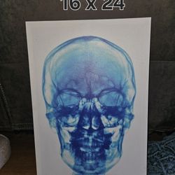 X Ray Skull Canvas