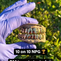 Gold Grillz DM To Get Started 