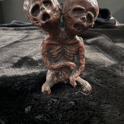 Sorrow And Agony Conjoined Twins 