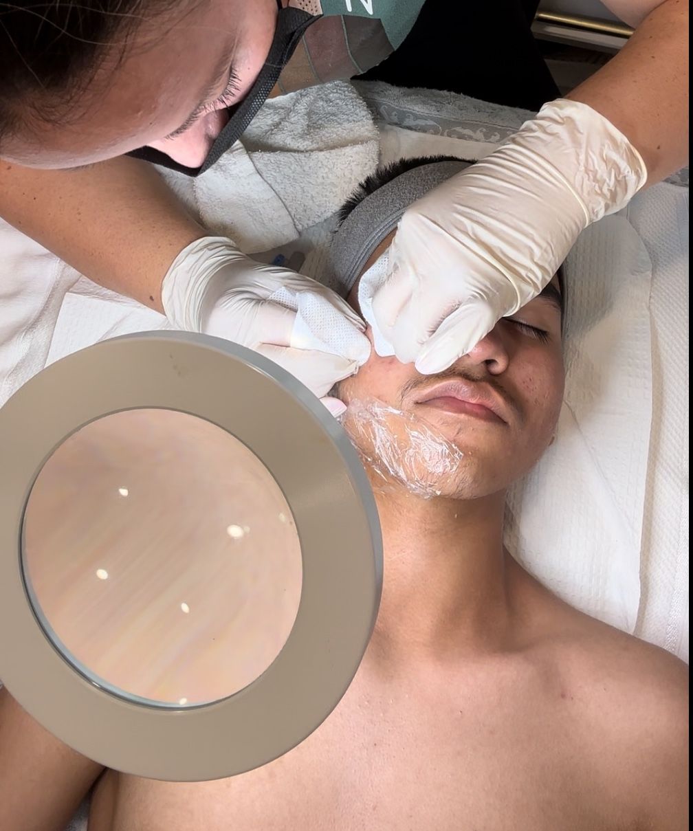 Facial Treatment