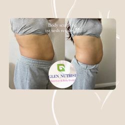 Body Sculpting Stomach Area Cavitation R F And More