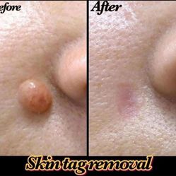 Skincare 