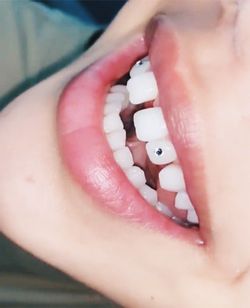 Tooth Gem