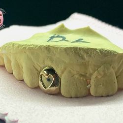 Custom GOLD GRILLZ 
