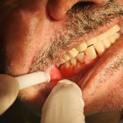 Dolor Productos Dd Limpieza Dental