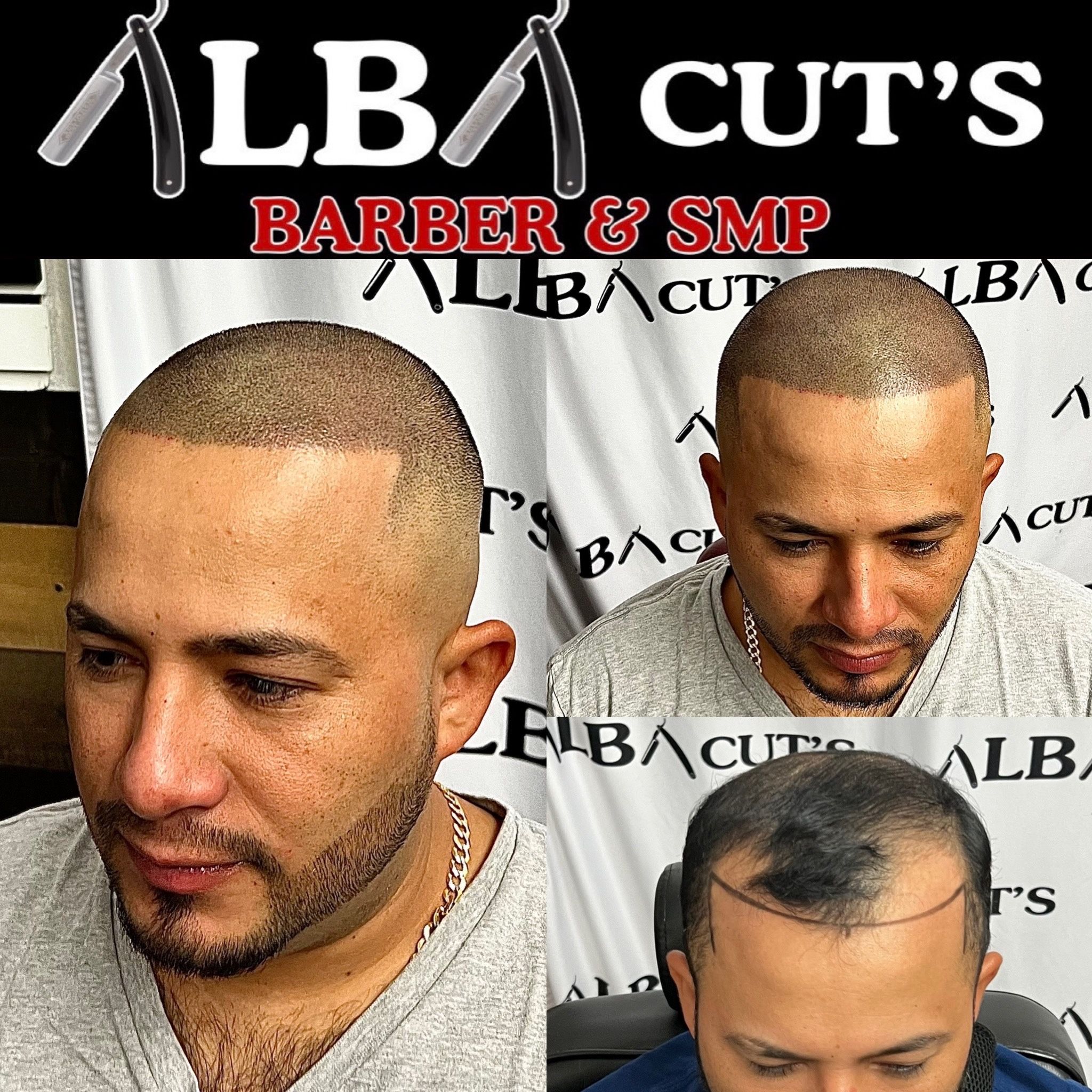 Smp Regain Your Confidence Regain Your Hairline