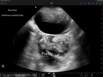Get Ultrasound