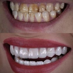 Free Dental Consultation and X Rays