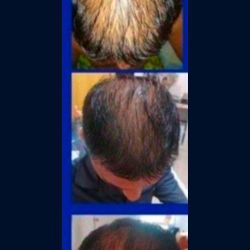 Shampoo Anti Caida Terramar