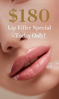 Lip filler