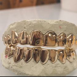 Custom Gold Grillz 