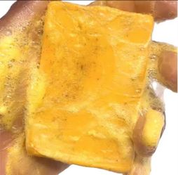 Turmeric Soap Set – 4 Bars for Acne & Dark Spots