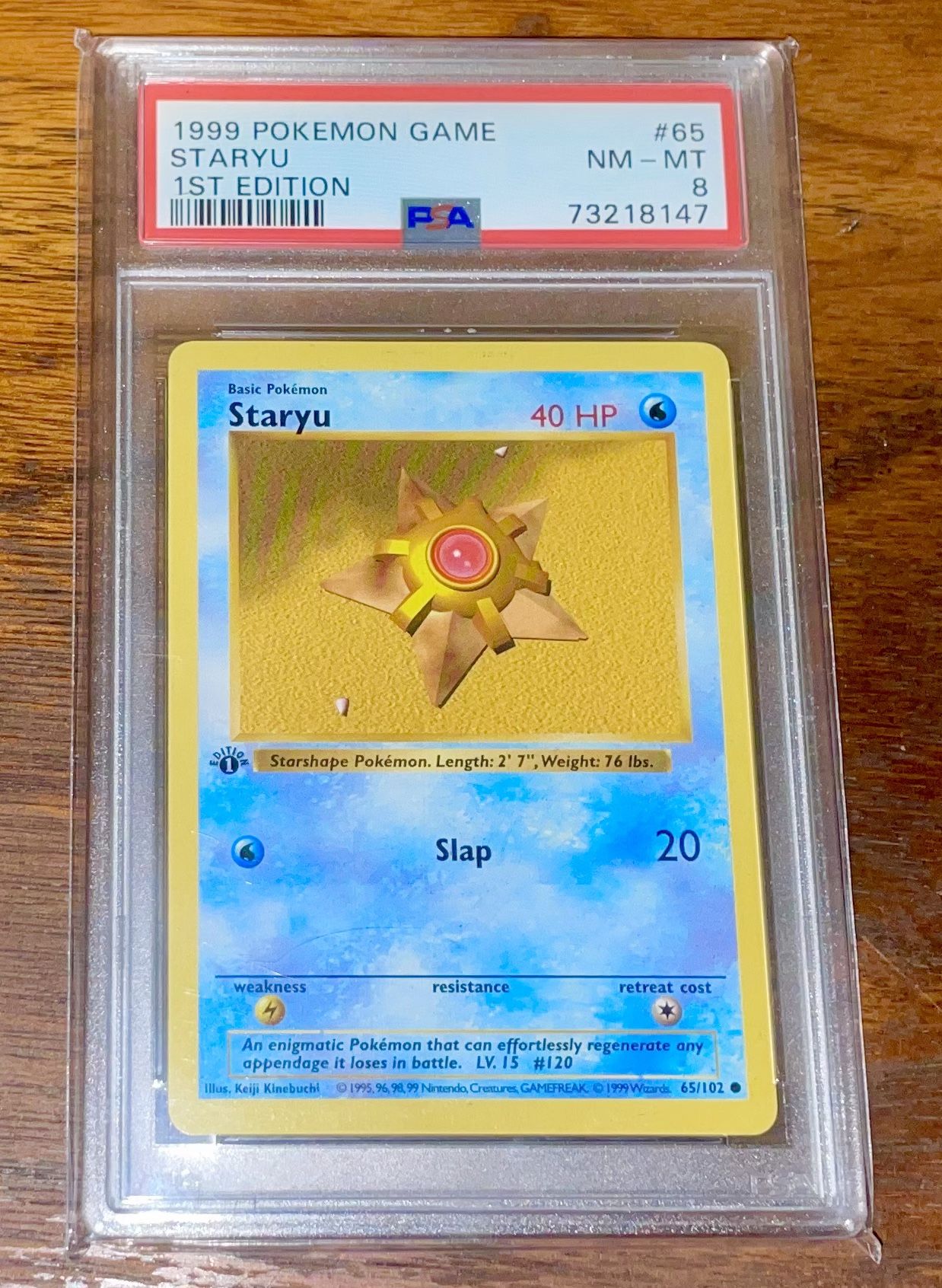 Pokemon - Staryu - #65 - Base Set *1st Edition* (Shadowless) --- PSA Graded: NM-MT 8