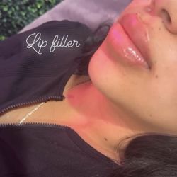 Lips