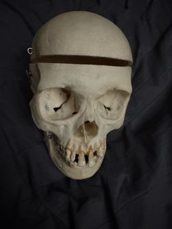 Medical skull