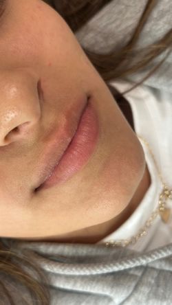 Lips