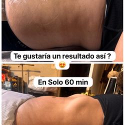 Massages Cavitation