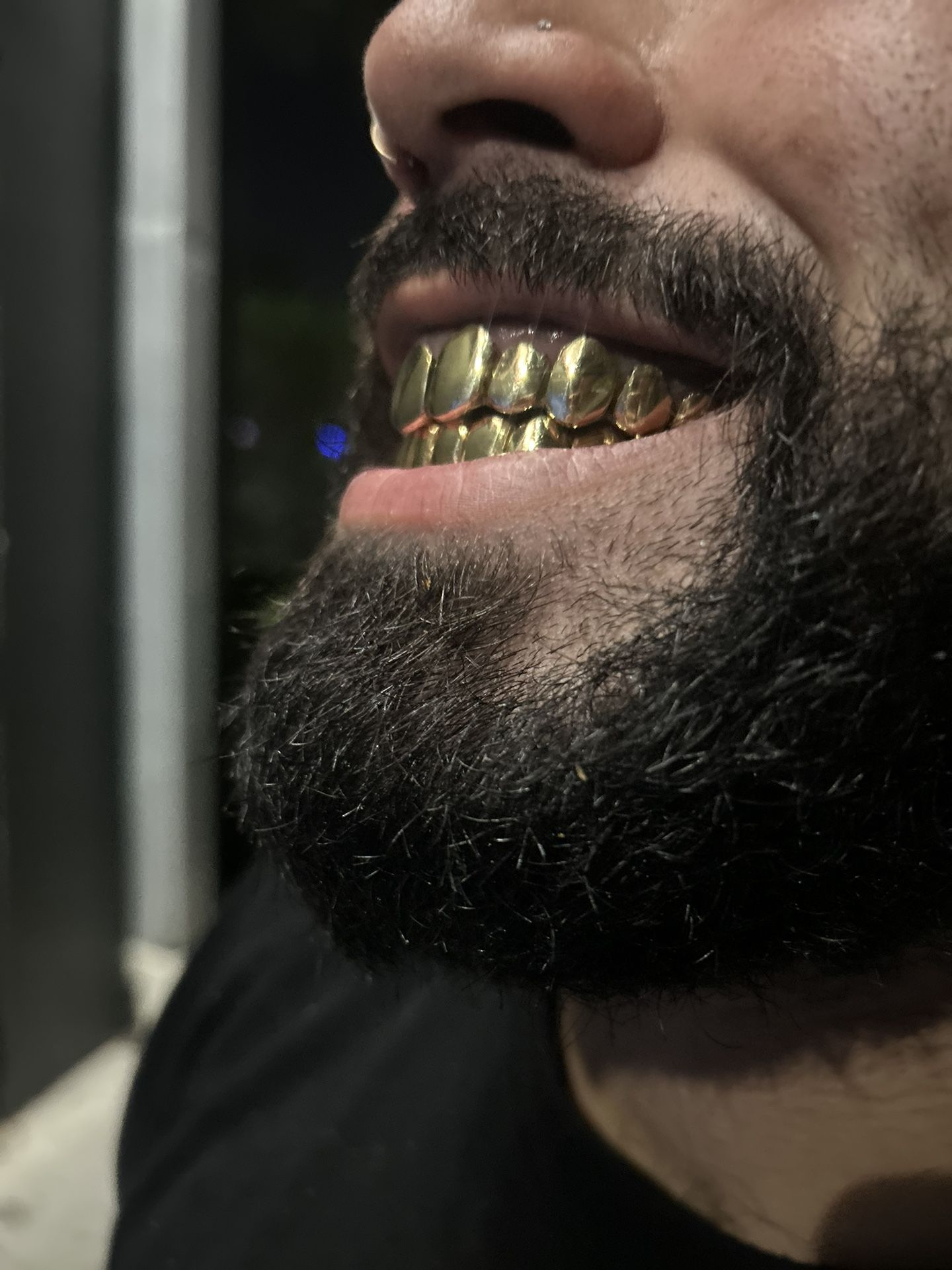 Gold Grillz Orlando Mobile Jeweler - NPG, Silver, 10k, 14k, And 18k