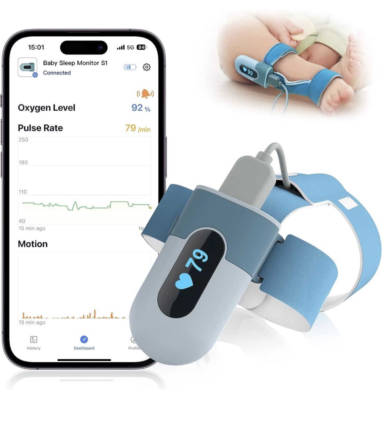 Infant Oxygen Monitor