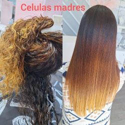 Celulas Madres 