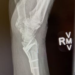 Foot control. For which embroidery machine