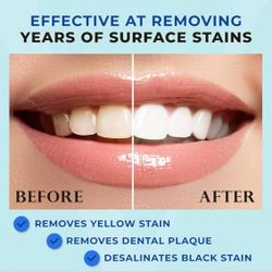 Brand New, Teeth Whitening Pens – 2 Pack, Easy & Portable