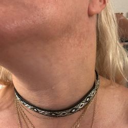 Black Choker 