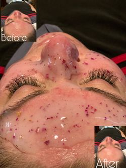 Eyelashes & face mask HydroJelly