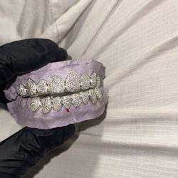 VVS MOISSANITE GRILLZ 💎