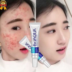 2 BioAQUA Acne Creams – $16 Total New & sealed. ✔ Fights acne and acne scars ✔ Reduces pores and oil ✔ Smooths and repairs skin 30g each. Great deal –
