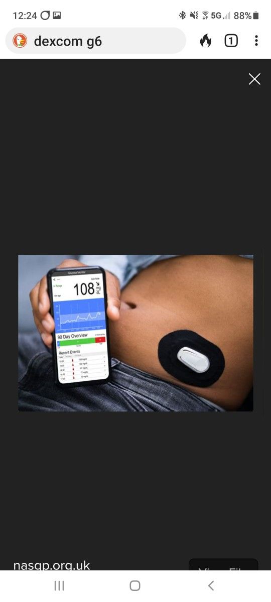 Dexcom G6 Constant Blood Glucose Monitor System