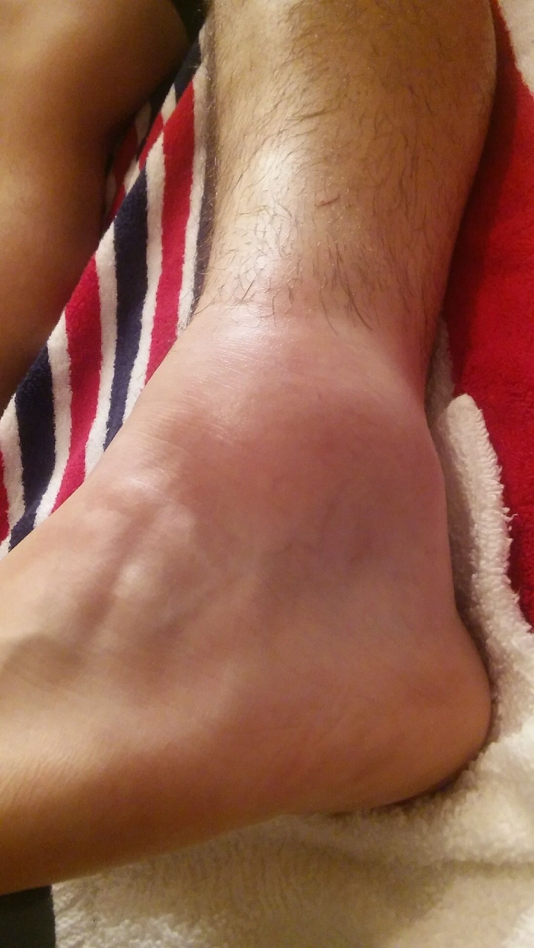 sobador Balsamo Para Sobar Torceduras