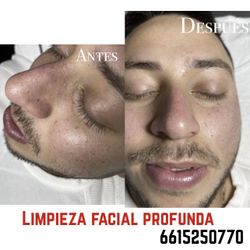 Facial Cleansing