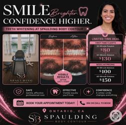 Teeth whitening