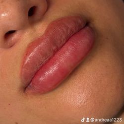 Lip Enhancement and fat Dissolver Vials For Body 