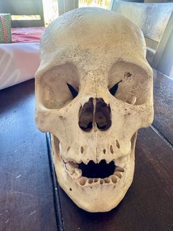 Human Skull (Medical Grade)