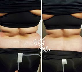 Skin Treatment Services
