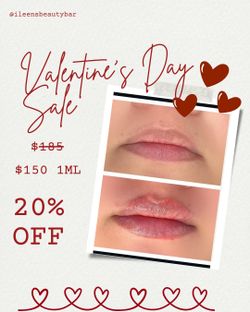Lip Filler