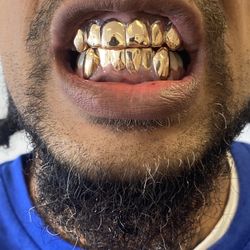 Gold Grillz