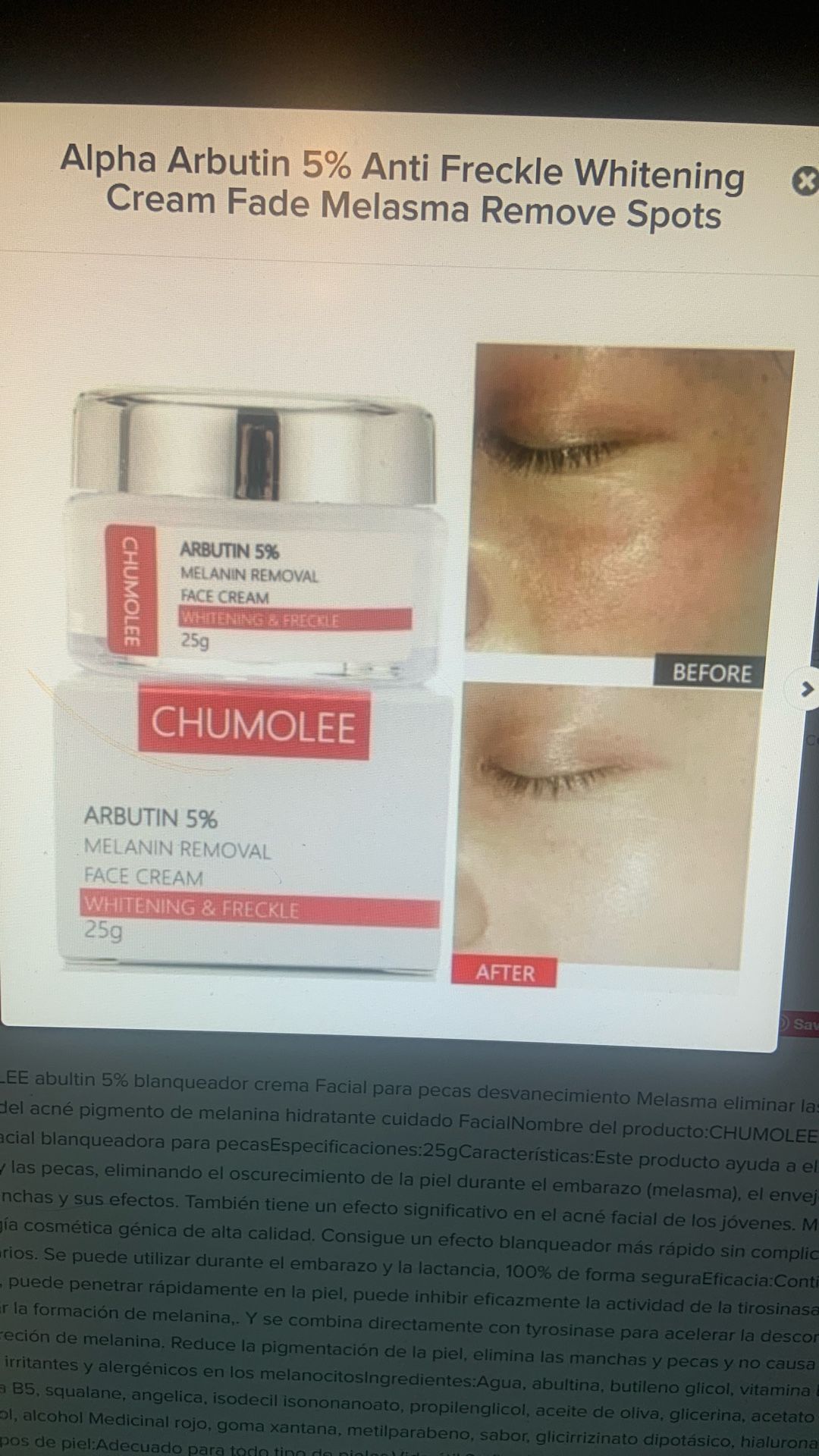 Cream For Dark Spot freckle cream